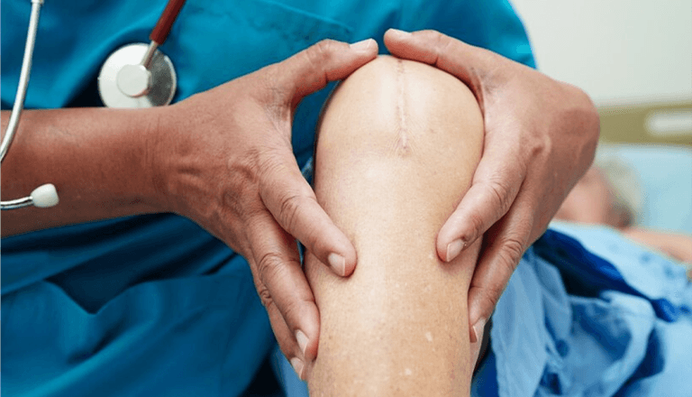 Tips for Knee Replacement Surgery