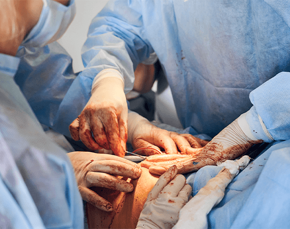 Open Abdominal Surgery