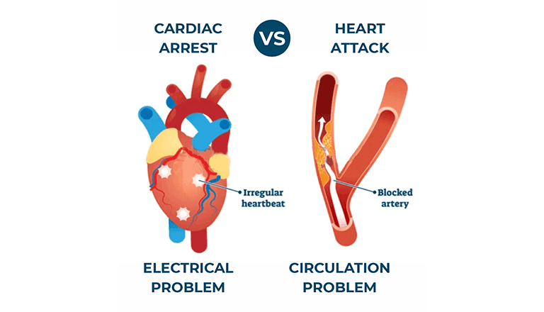 Difference between Heart Attack and Cardiac Arrest