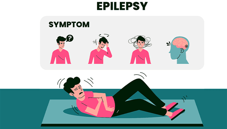 Epilepsy