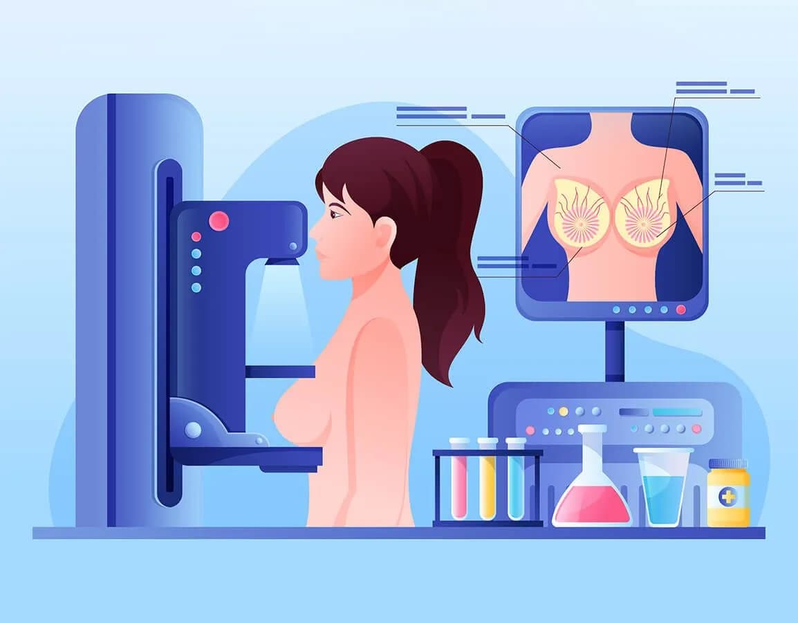 Mammography