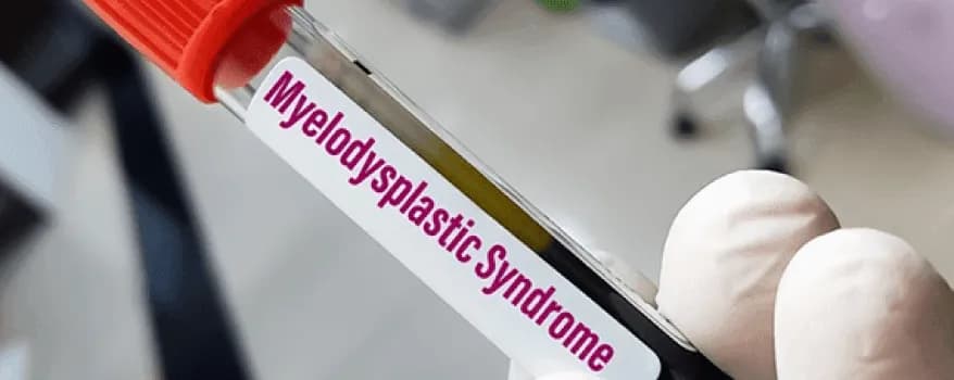 Myelodsplastic syndrome