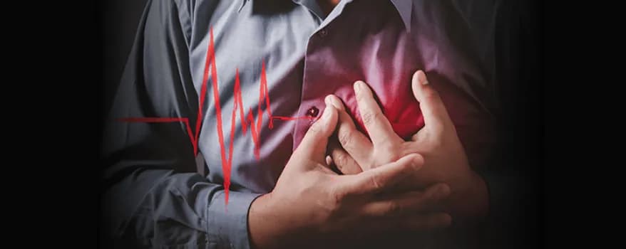 Myocardial infarction