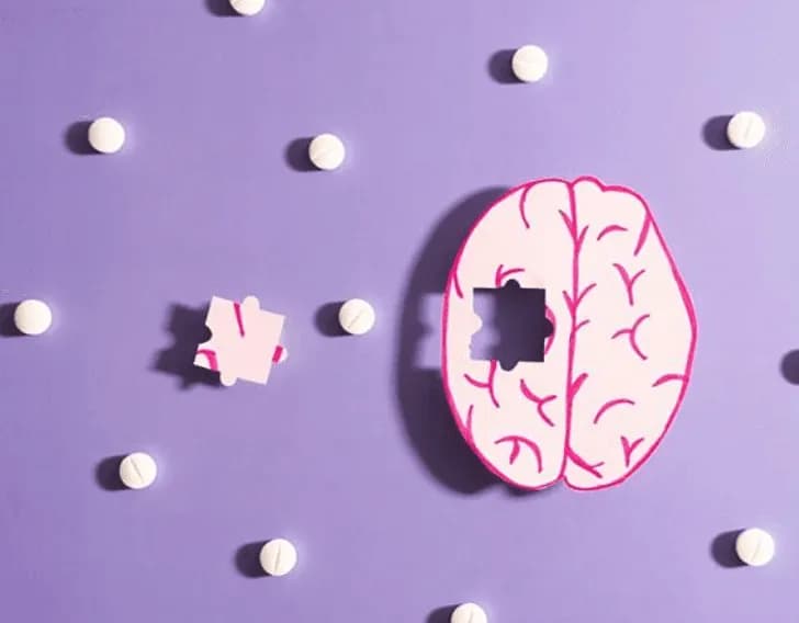 Alzheimer’s Disease
