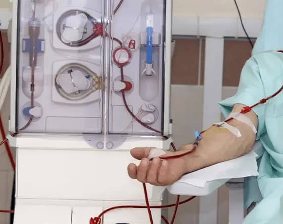 Dialysis