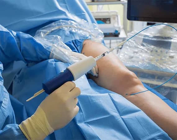Total Knee Replacement