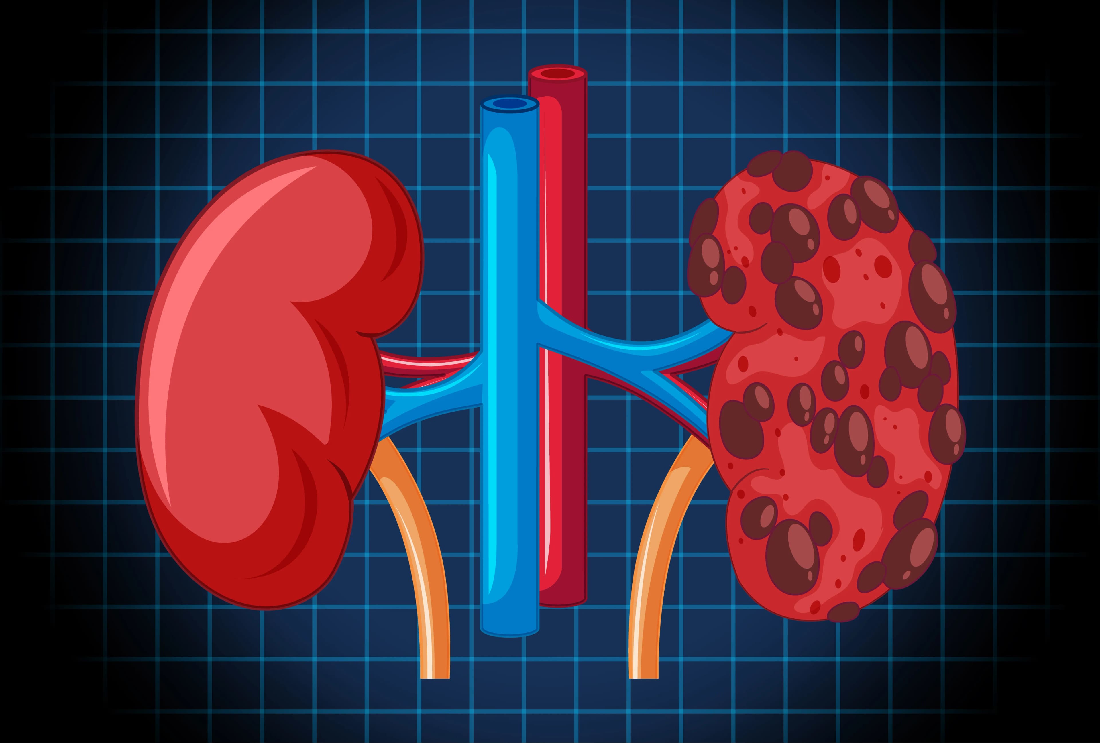 Kidney Failure Symptoms You Should Never Ignore — And What Comes Next