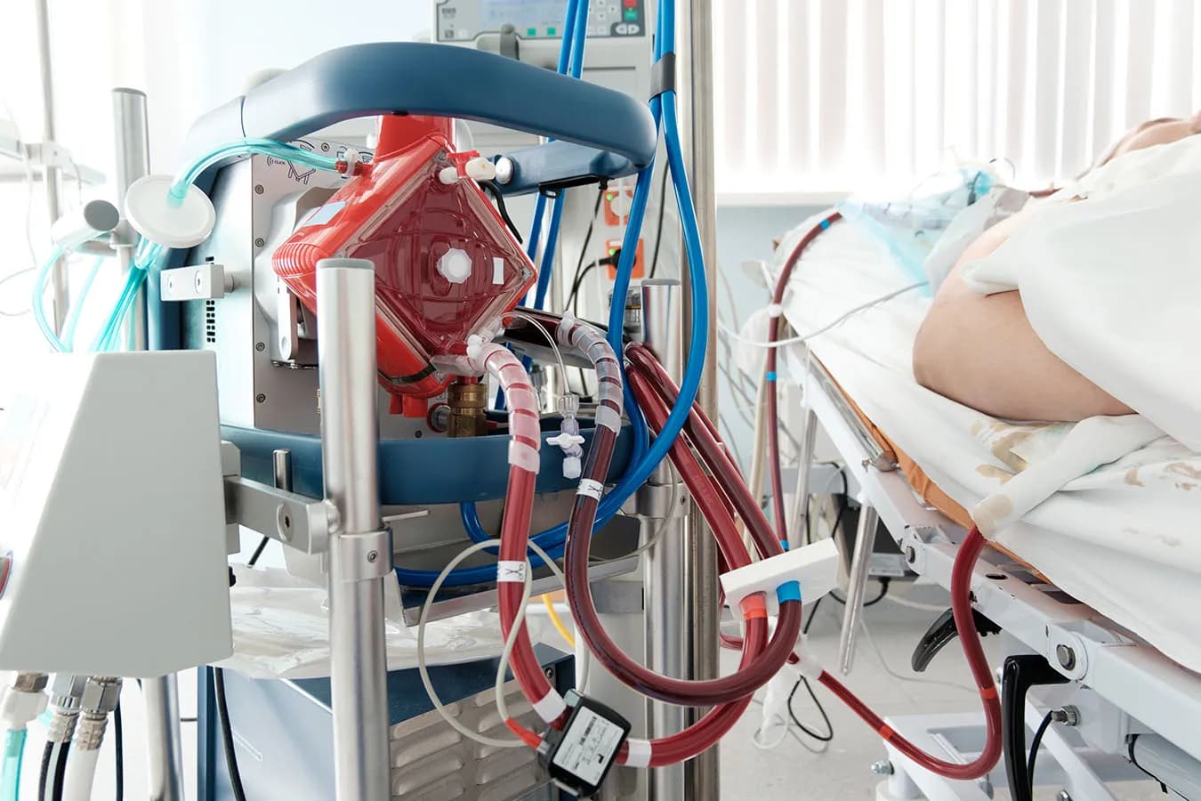 How ECMO Supports Heart Function: A Clinical Guide