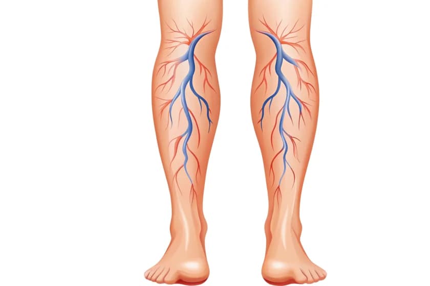Vascular Trauma: Why the Golden 6 Hours Can Save Your Limb